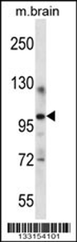 ITCH Antibody (Center)