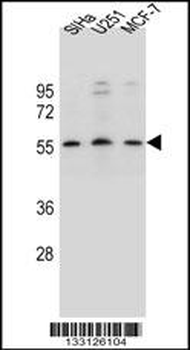 KCNK18 Antibody (Center)