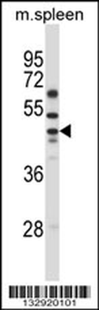 SLC30A6 Antibody (Center)