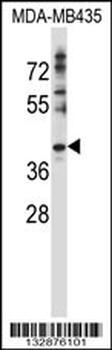 DNAJC28 Antibody (C-term)