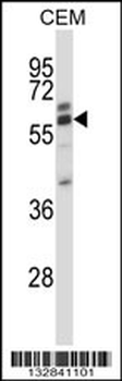 CORO2A Antibody (Center)