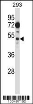 FIZ1 Antibody (C-term)