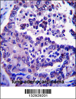 ARL8A Antibody (Center)
