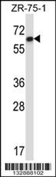 DCTN4 Antibody (N-term)