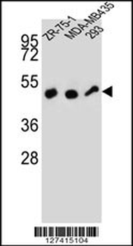 ZFP30 Antibody (N-term)