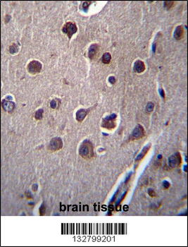 KCTD10 Antibody (C-term)