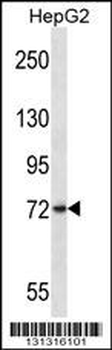 FRMD7 Antibody (N-term)