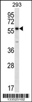 PNPLA1 Antibody (N-term)