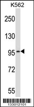 PDE6A Antibody (Center)