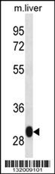 LSM12 Antibody (C-term)