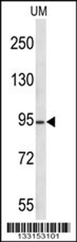 KAT2A Antibody (C-term)