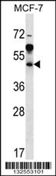 ARFIP1 Antibody (Center)