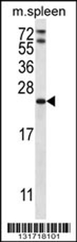 RAP1A Antibody (C-term)