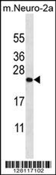 ZCRB1 Antibody (C-term)