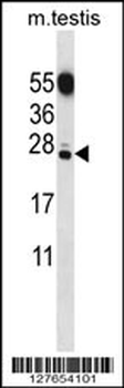 CT011 Antibody (N-term)