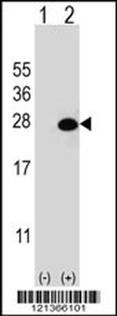 DGCR6L Antibody (Center)