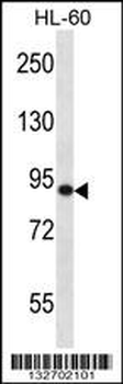 SP140 Antibody (Center)
