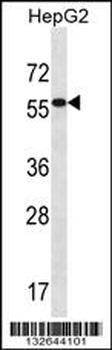 ALDH3B2 Antibody (C-term)