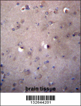 ALDH3B2 Antibody (C-term)
