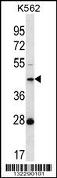 F105A Antibody (Center)