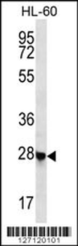 CL052 Antibody (N-term)
