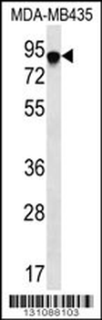 FYB Antibody (C-term)