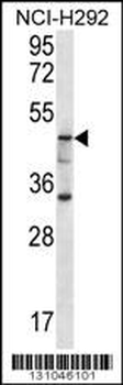 GBA3 Antibody (C-term)