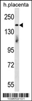 INTS1 Antibody (N-term)