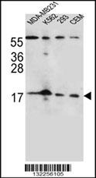 FGF22 Antibody (N-term)