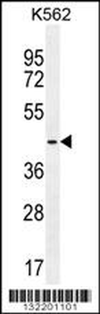 TBPL2 Antibody (N-term)