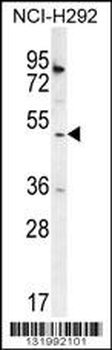 SH2D4A Antibody (N-term)
