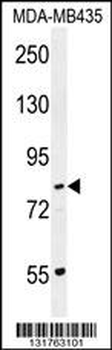 PCDHGA1 Antibody (Center)