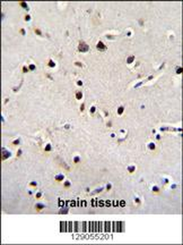LRRC46 Antibody (N-term)