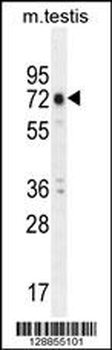 ANKRD5 Antibody (C-term)