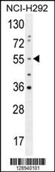 OTUD1 Antibody (Center)