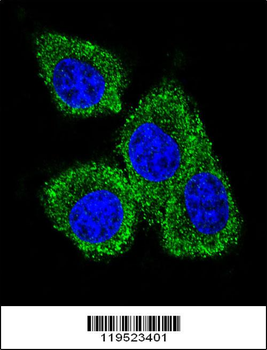 GCDFP-15 Antibody (C-term)