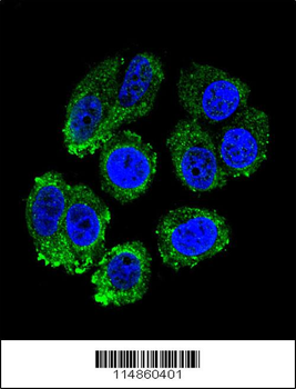 RARS Antibody (C-term)
