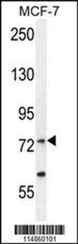 RARS Antibody (C-term)
