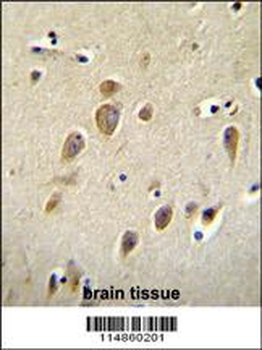 RARS Antibody (C-term)