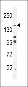 His6-DEP-1 Antibody