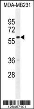 GNL3L Antibody (N-term)