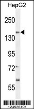 CT117 Antibody (N-term)