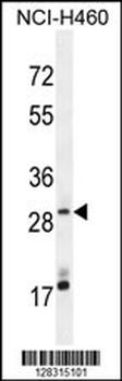 MAGIX Antibody (C-term)