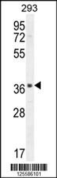 SACA1 Antibody (N-term)