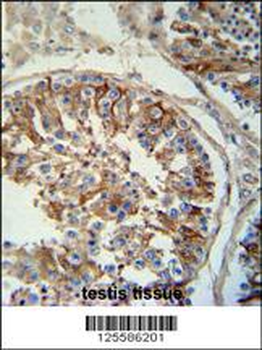 SACA1 Antibody (N-term)