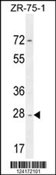 NDUFAF1 Antibody (C-term)