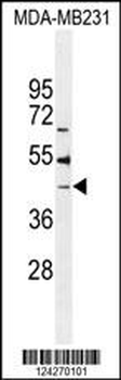 B4GALT6 Antibody (C-term)
