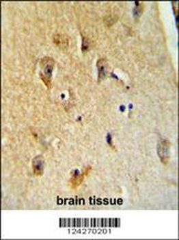 B4GALT6 Antibody (C-term)