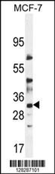 LYSMD4 Antibody (N-term)