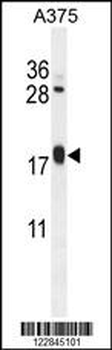 ARL8A Antibody (Center)